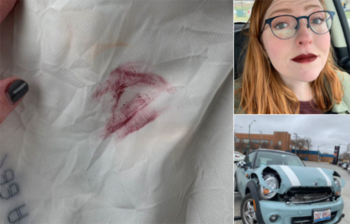 Woman all praises for her lipstick as it stays even after car crash